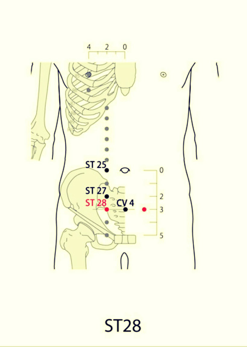 Saro Epic Acupuncture Clinic Acupuncture Points for Polycystic Ovarian
