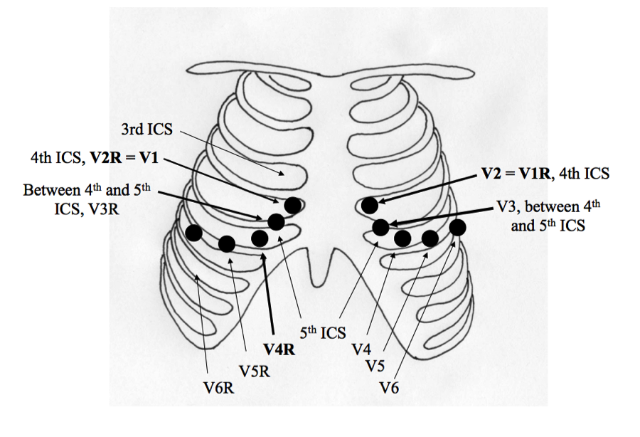 Download Ekg V3R V4R คือ Pics