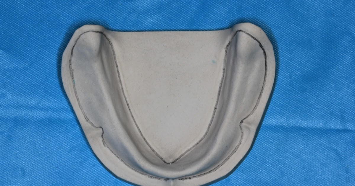 Step by step Guide for Understanding the Prosthodontics Spacer for