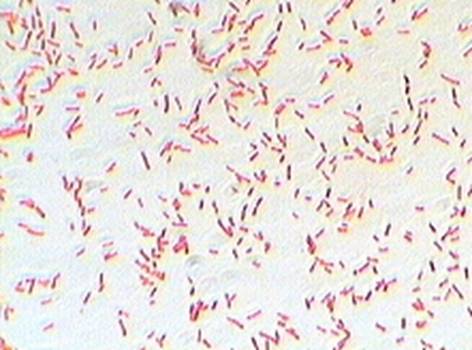 Ciprofloxacin Eye Solution; Ciloxan: Side Effects, Dosage Ciprofloxacin Bakterielle Infektion Online bestellen