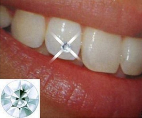 KLINIK PERGIGIAN SYARIFAH: Tooth Piercing