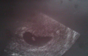 .Our Baby At 6 Weeks.