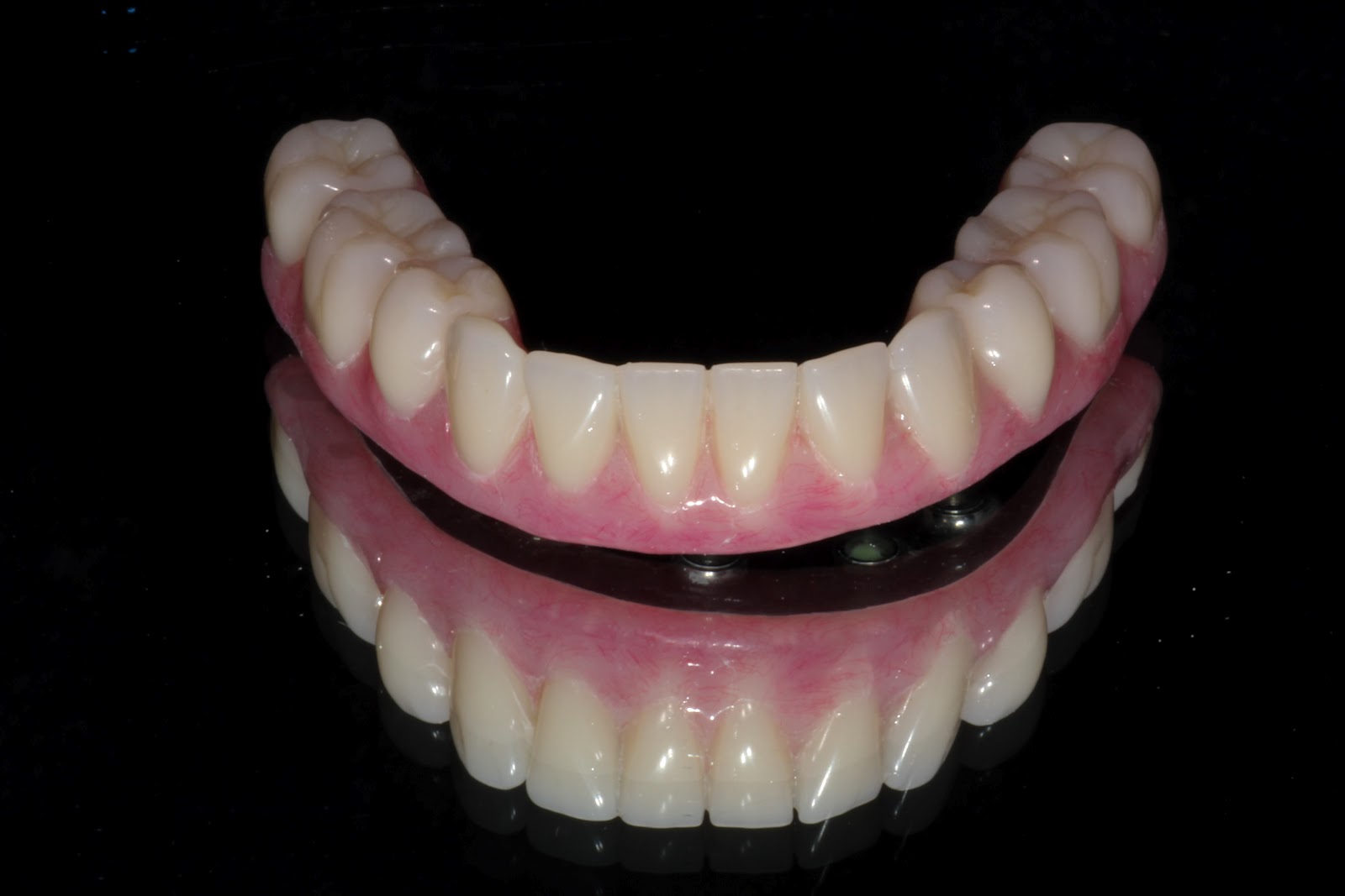 Boise Idaho Prosthodontics Maxillary Complete Denture / Mandibular 5