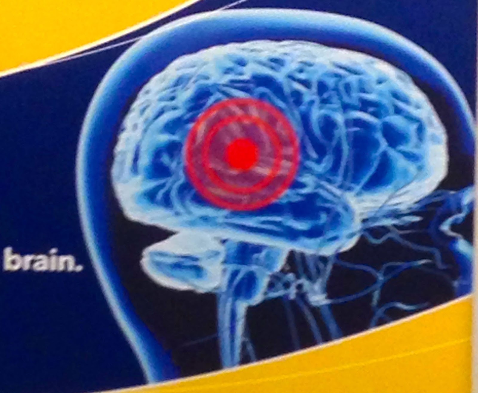 Secretly compelled brain improvements Therapist Ex- FBI objectives are defended by builder Secretly compelled brain improvements Therapist Ex- FBI objectives are defended by builder