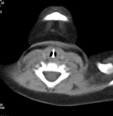 body scans and bottleneck case Body scans and bottlenecks: body scans and bottlenecks: optimizing hospital ct process flows access to case studies expires six months after purchase date. body scans and bottleneck case Body scans and bottlenecks: body scans and bottlenecks: optimizing hospital ct process flows access to case studies expires six months after purchase date.