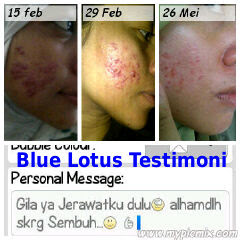 Blue Lotus Acne Skin Care