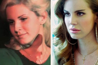 lana_del_rey-plastic-surgery-before-and-after.jpg