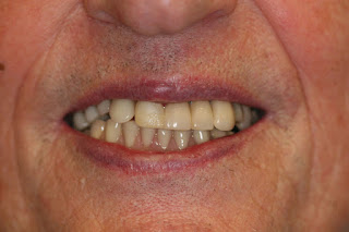 Golpa-DentalImplantCenter.com