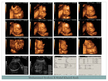 ~ Our baby's in 3D ~ Syahmi