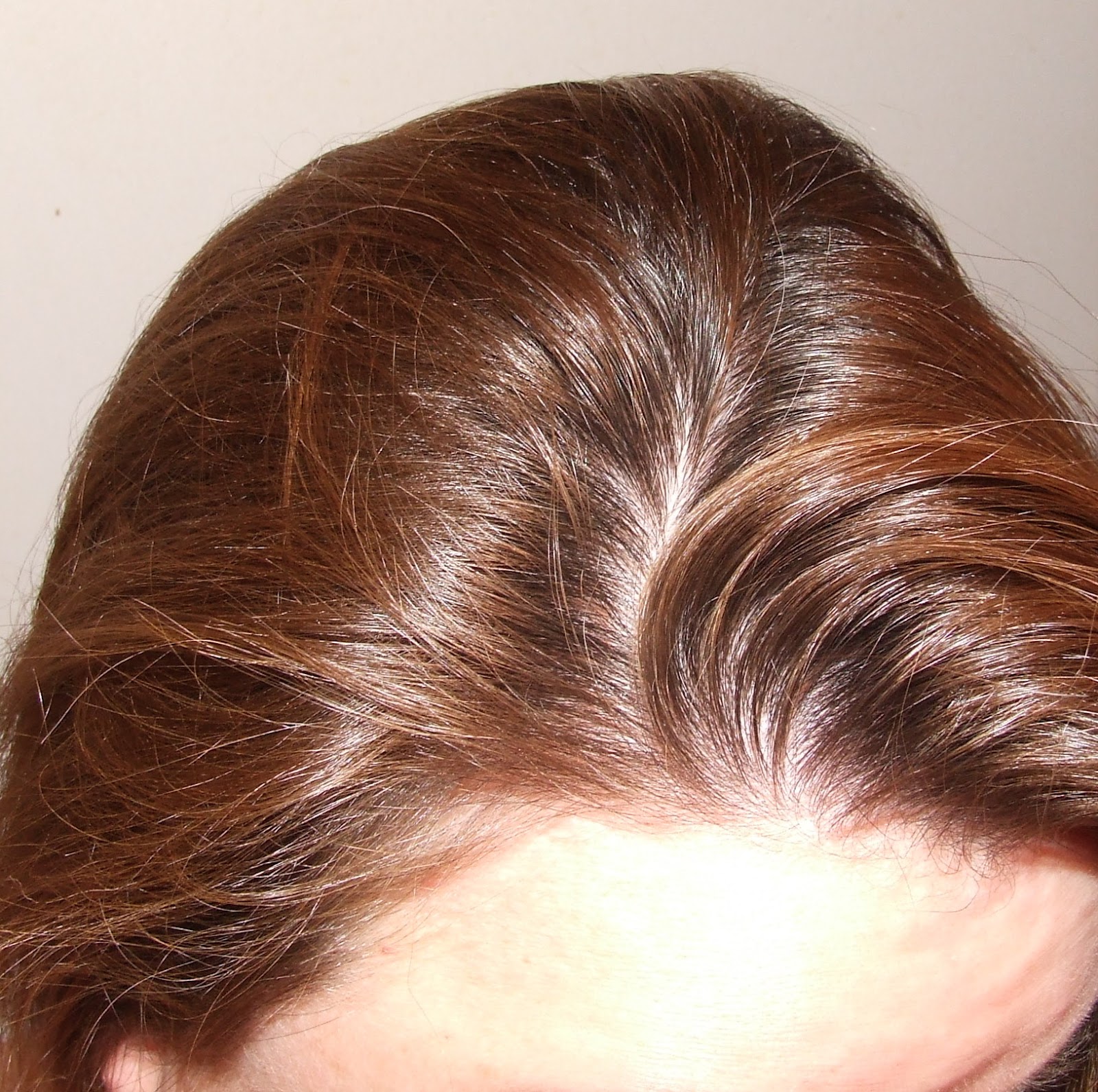 Álbumes 90+ Imagen Why Do The Roots Of My Hair Hurt Lleno