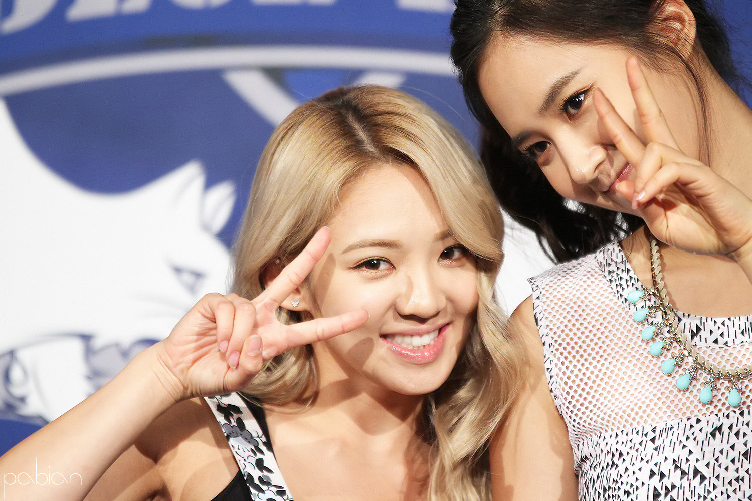 [Disc] Official Plastic Surgery Thread - Page 85 - Celebrity Photos