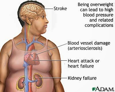 Effective weight loss philippines picture 8