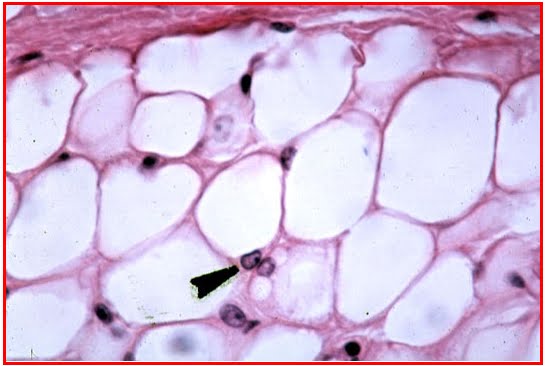 Gambar Jaringan Adiposa