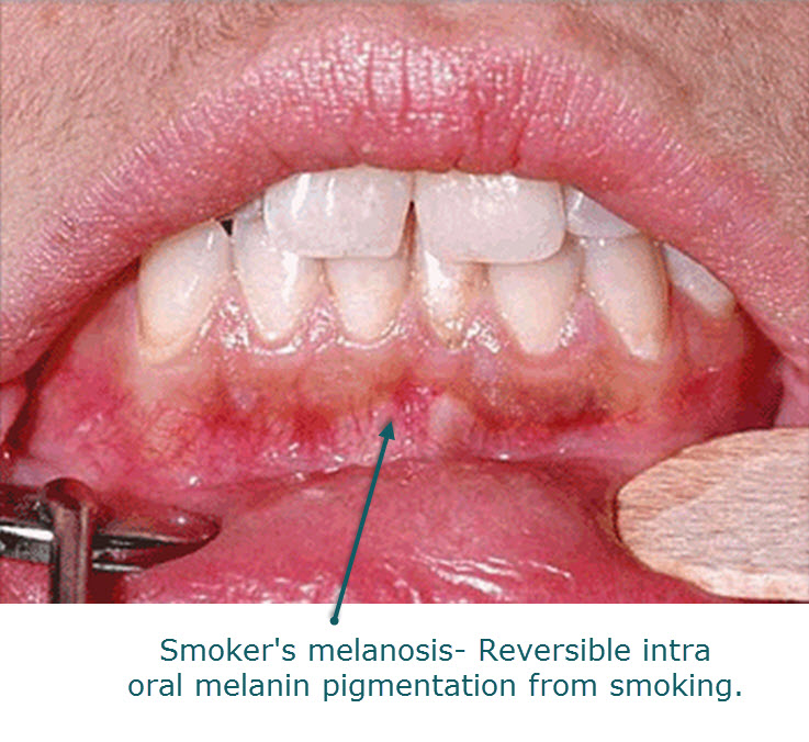 Dermatology For Dentists and Dental Students Oral Medicine for Dental