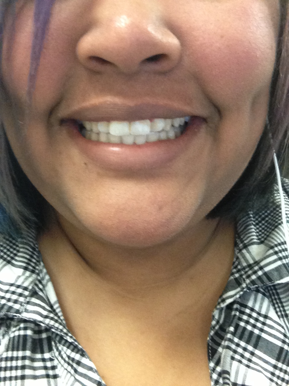 Wickee Reviews! Crest 3D White Professional Effects Whitestrips