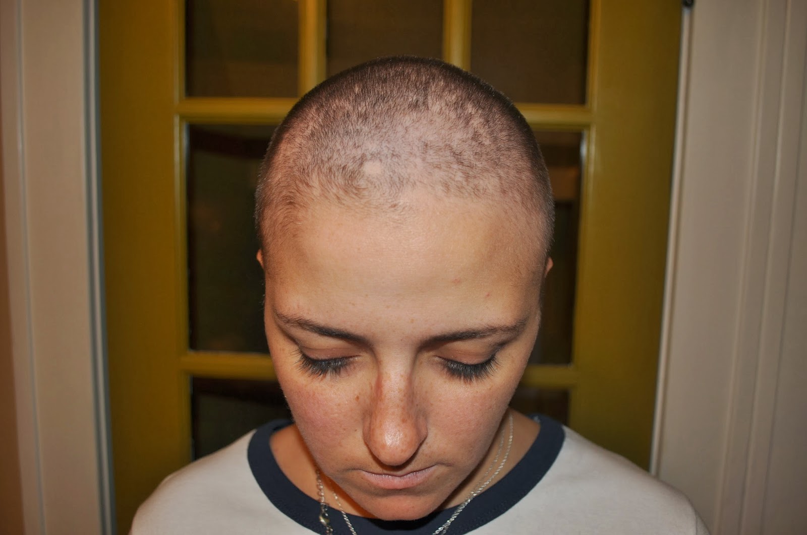 Carri Us Home Chemo 2 & I'm Losing My Mind...and My Hair!