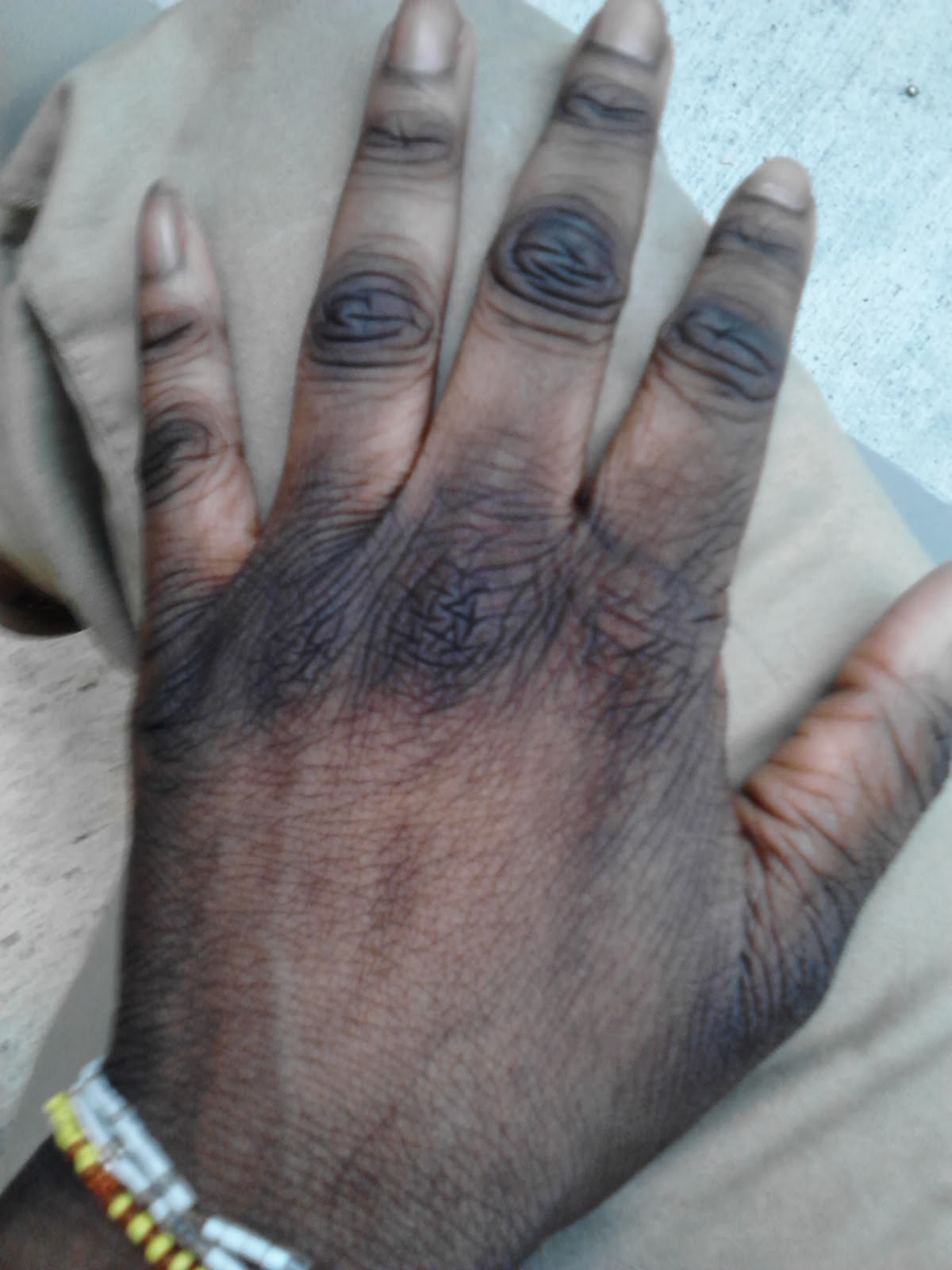 Checkout fast and effective ways to clear your dark knuckles Daily