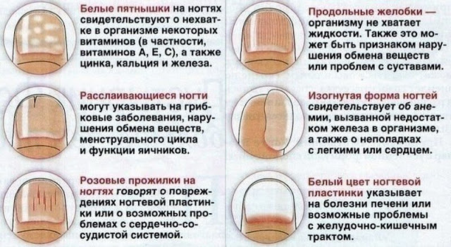 О чем говорят цвет маникюра О чем говорят цвет маникюра