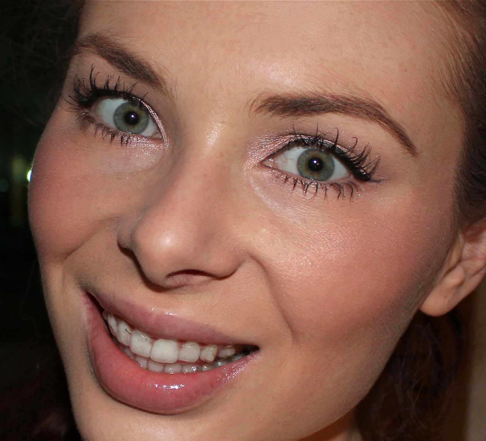 Invisalign Update Natalya's Beauty Blog