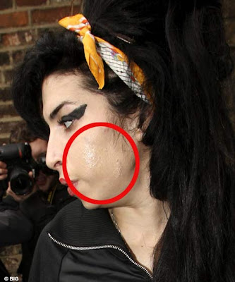 Amy Winehouse Body