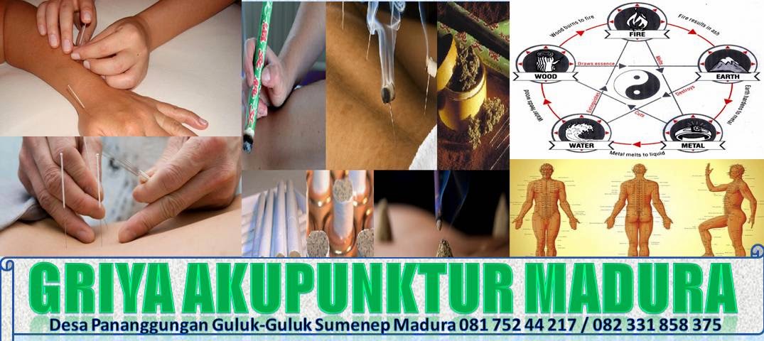 GRIYA AKUPUNKTUR MADURA