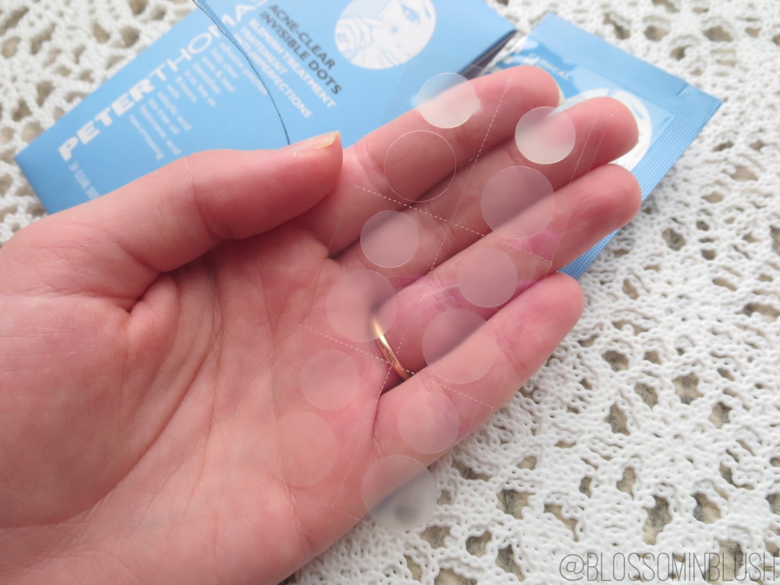 Product Review Peter Thomas Roth AcneClear Invisible Dots / Blossom