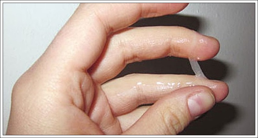 Белые Жидкие Выделения После Секса