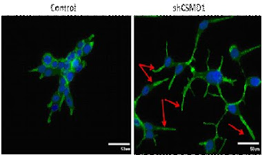 The effect of CSMD1 on cell cytoskeleton