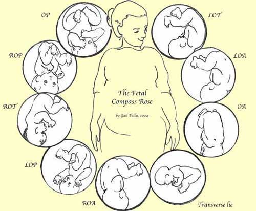 Mama Monday - Focus on Fetal Positioning for a Better Birth