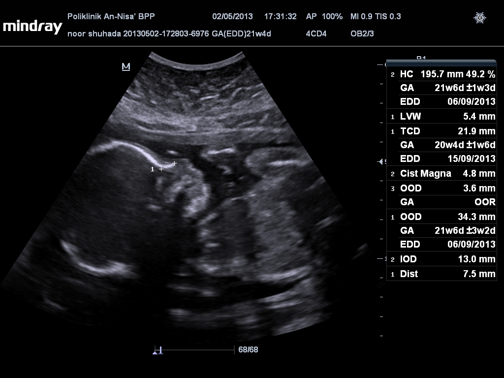 ♥ Pieces of Me ♥ Detail scan week 21