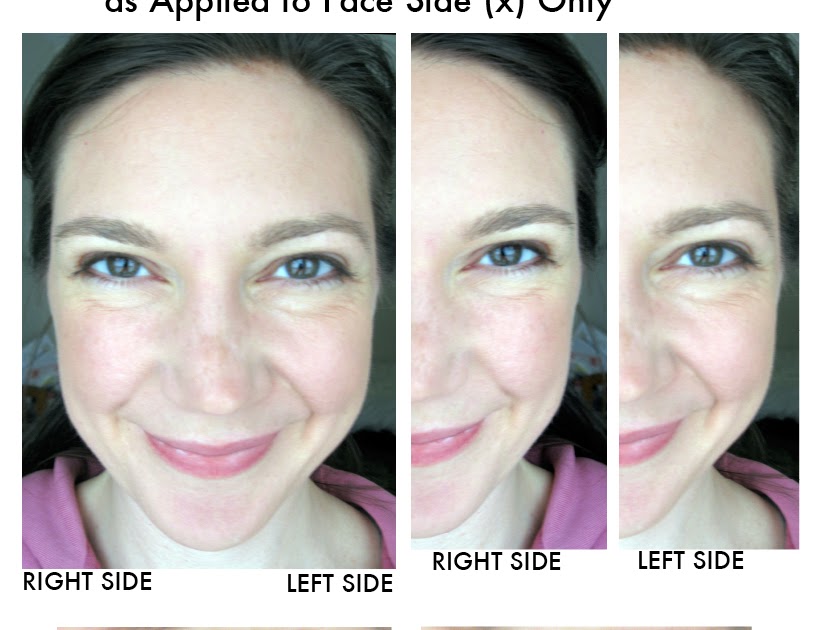 Beauty, and What It Means Please Vote Which Half of My Face Looks Younger