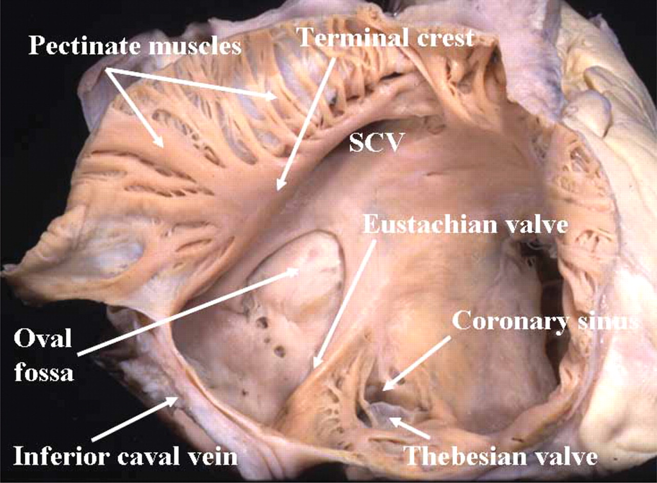 KNOW UR HEART: ANATOMY OF THE HEART