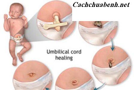 [Image: cham-soc-ron-tre-so-sinh11.JPG]