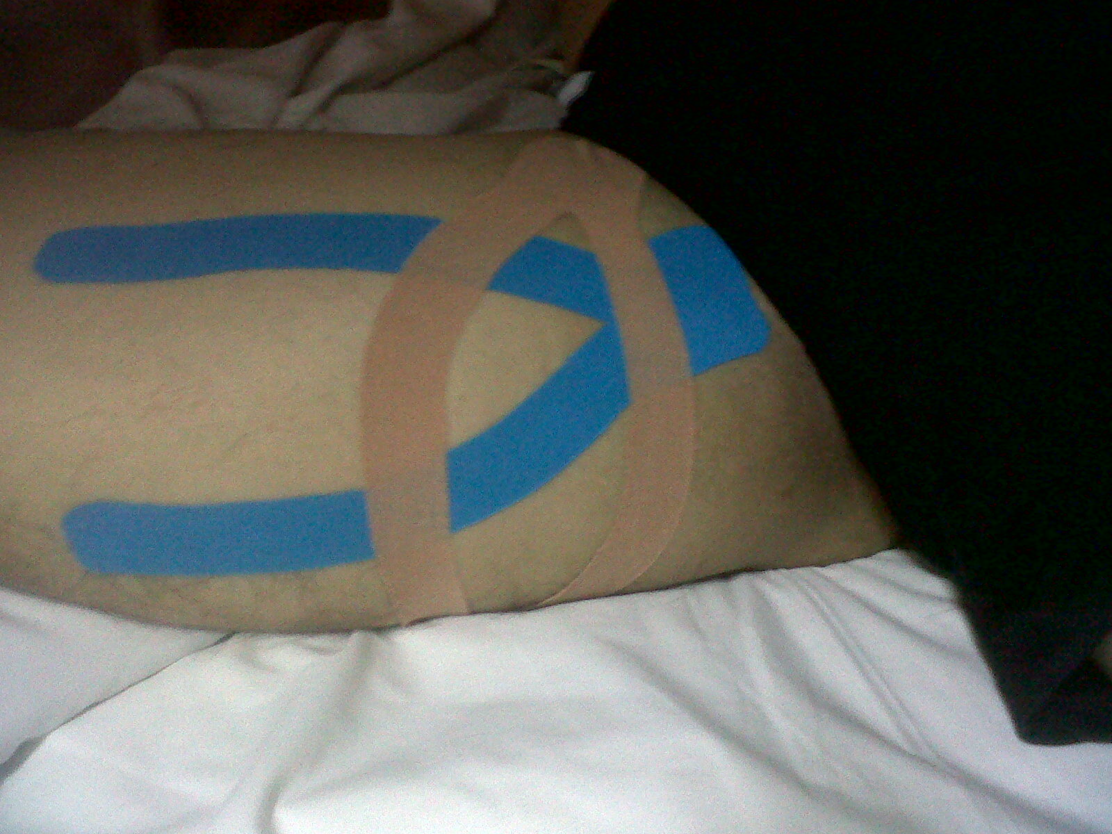 Physical therapists What is KT Tape.?