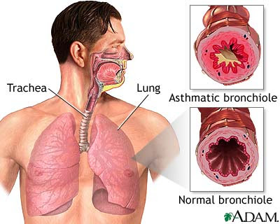 Steroid inhaler for cough side effects