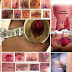 Jual Obat Wasir Murah Bukan Murahan thumbnail