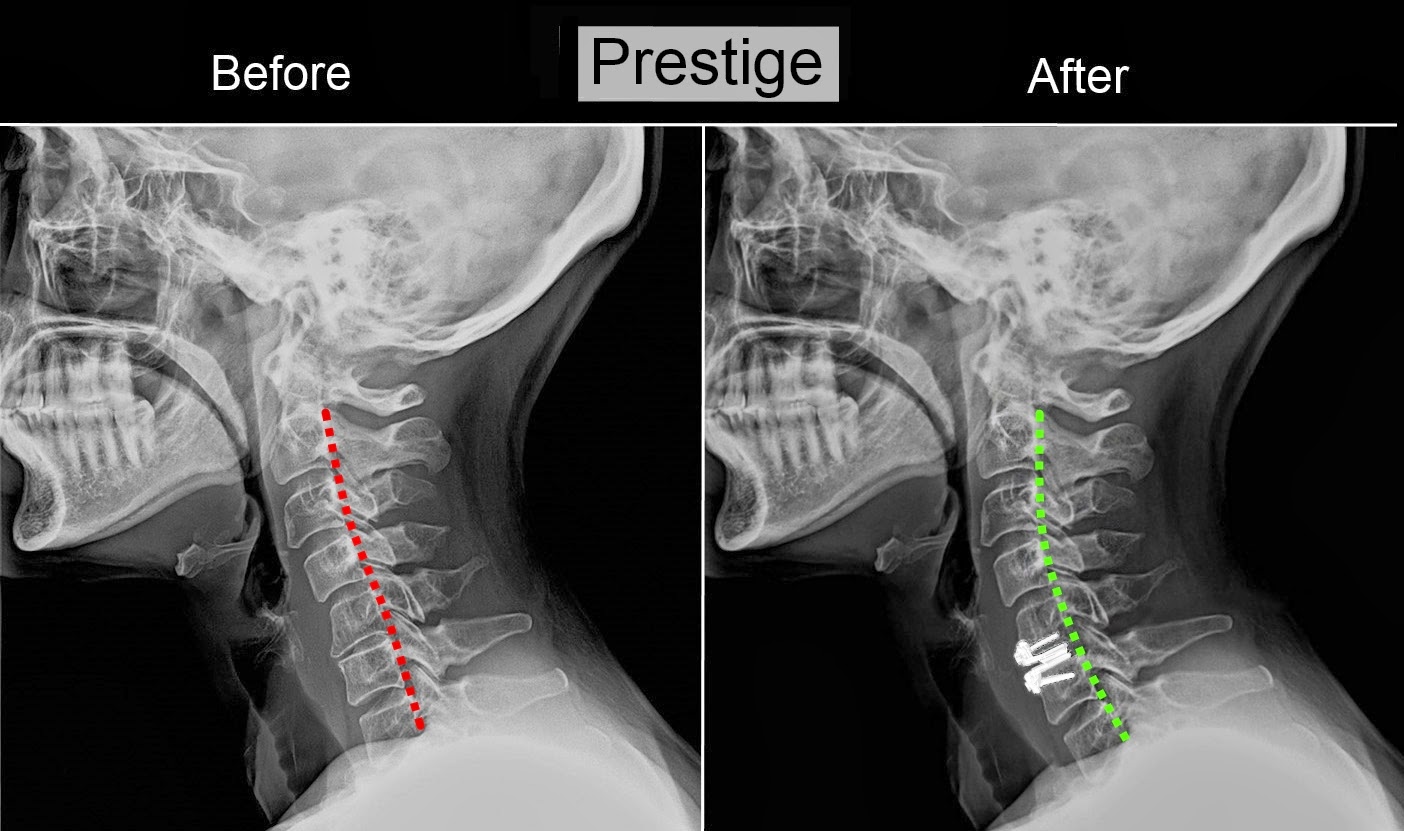 Deaf Events In Sf Ca Silent Grapevine