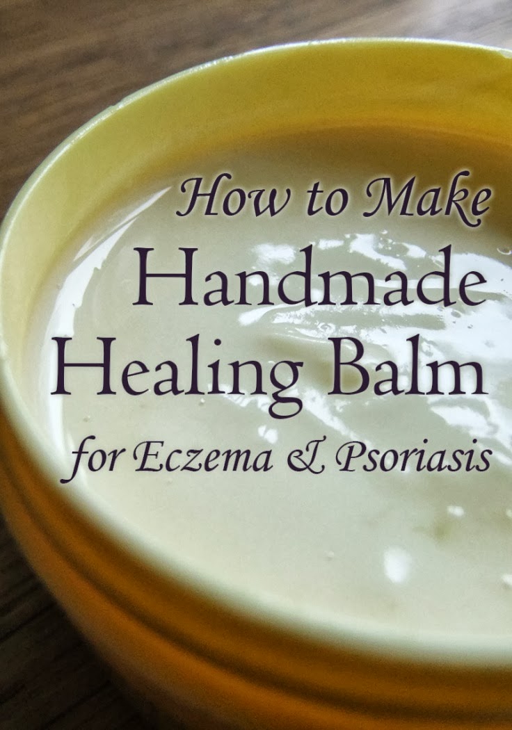 Handmade Healing Balm for Eczema and Psoriasis Lovely Greens
