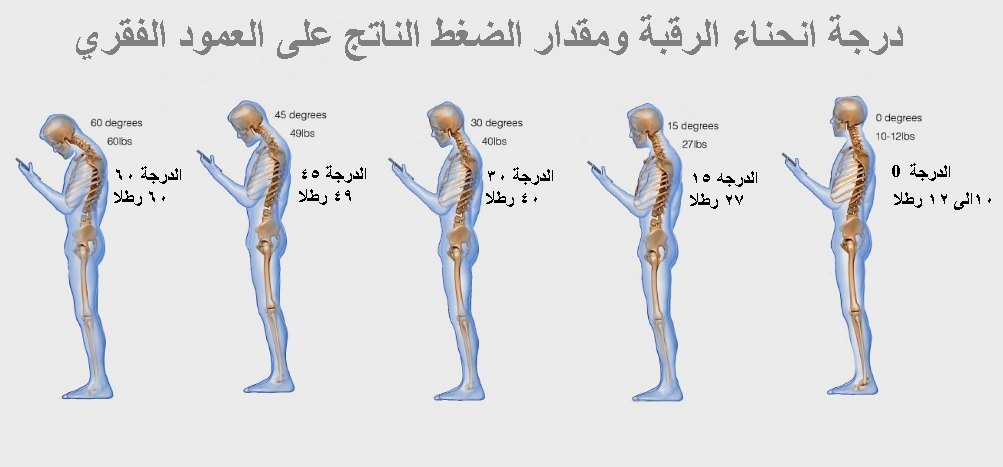 نتيجة بحث الصور عن رقبة النصوص\