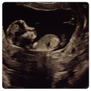 My baby number 2!