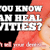 How to Heal Cavities Naturally