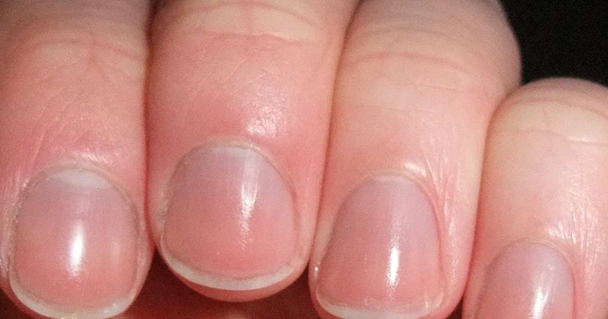 MAILS FROM FRIENDS: က်န္းမာေနေသာ အမ်ိဳးသားတို႔၏ လကၡဏာ (၅)ရပ္