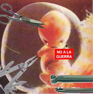 Abortos De Bebes