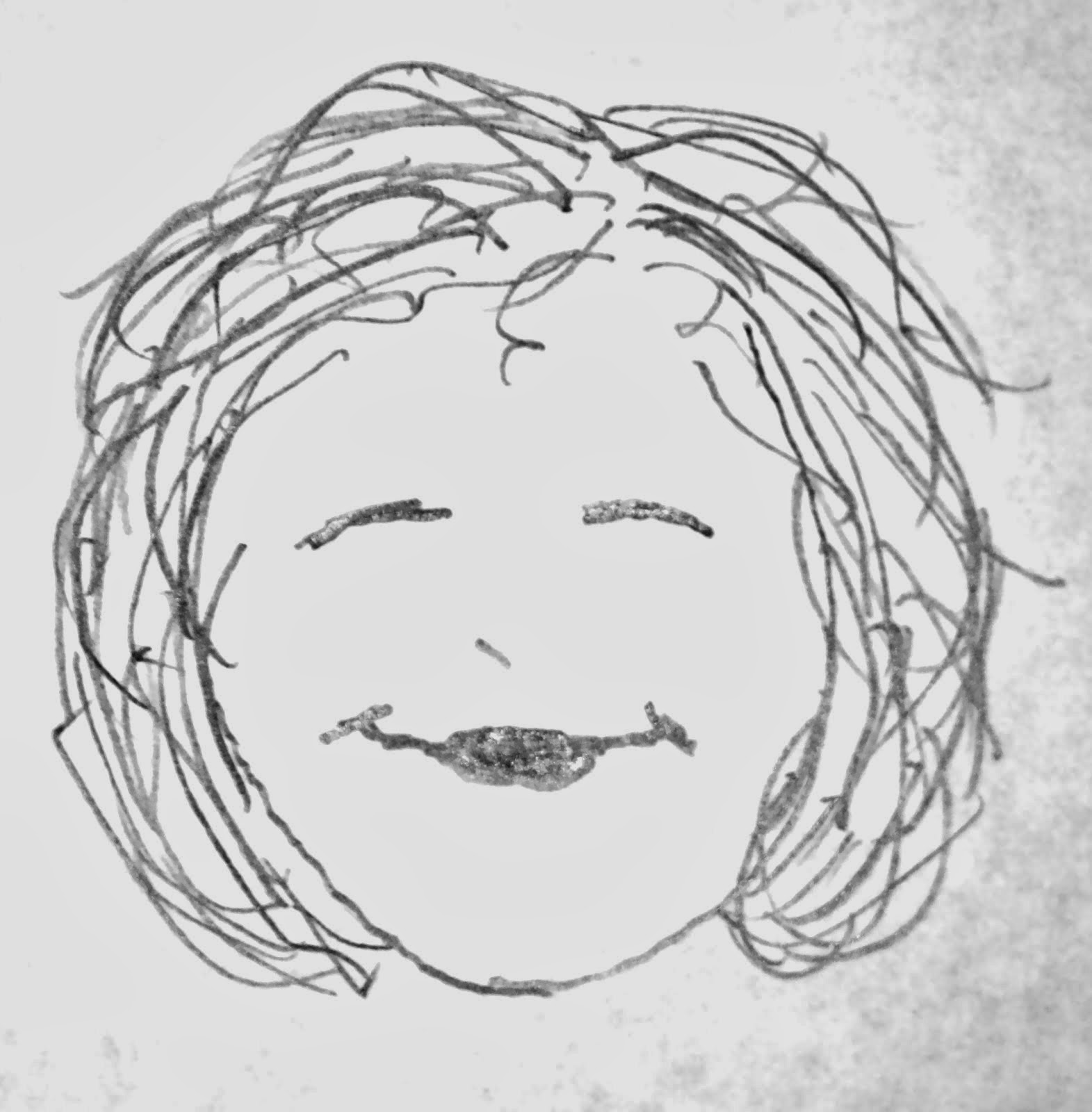 Reasonably Well: Sjogren's Syndrome and Livedo Reticularis