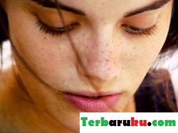Cara Menghilangkan Noda Hitam Pada Wajah Cara Menghilangkan Noda Hitam Pada Wajah
