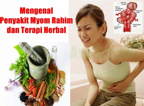 mengenal-myom-rahim-dan-terapi-herbal mengenal-myom-rahim-dan-terapi-herbal