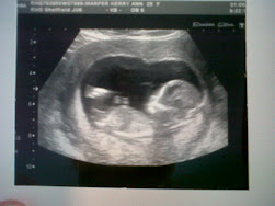 Baby Marper (12 week scan)