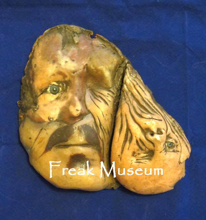 Freak Museum A Private Collection: Anatomical Museums