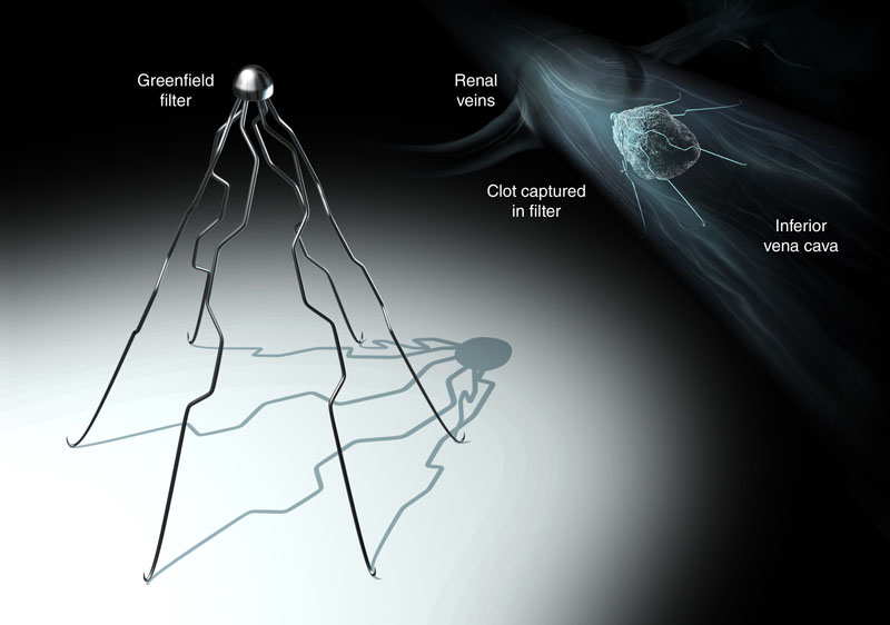 I Got Nothing Filters