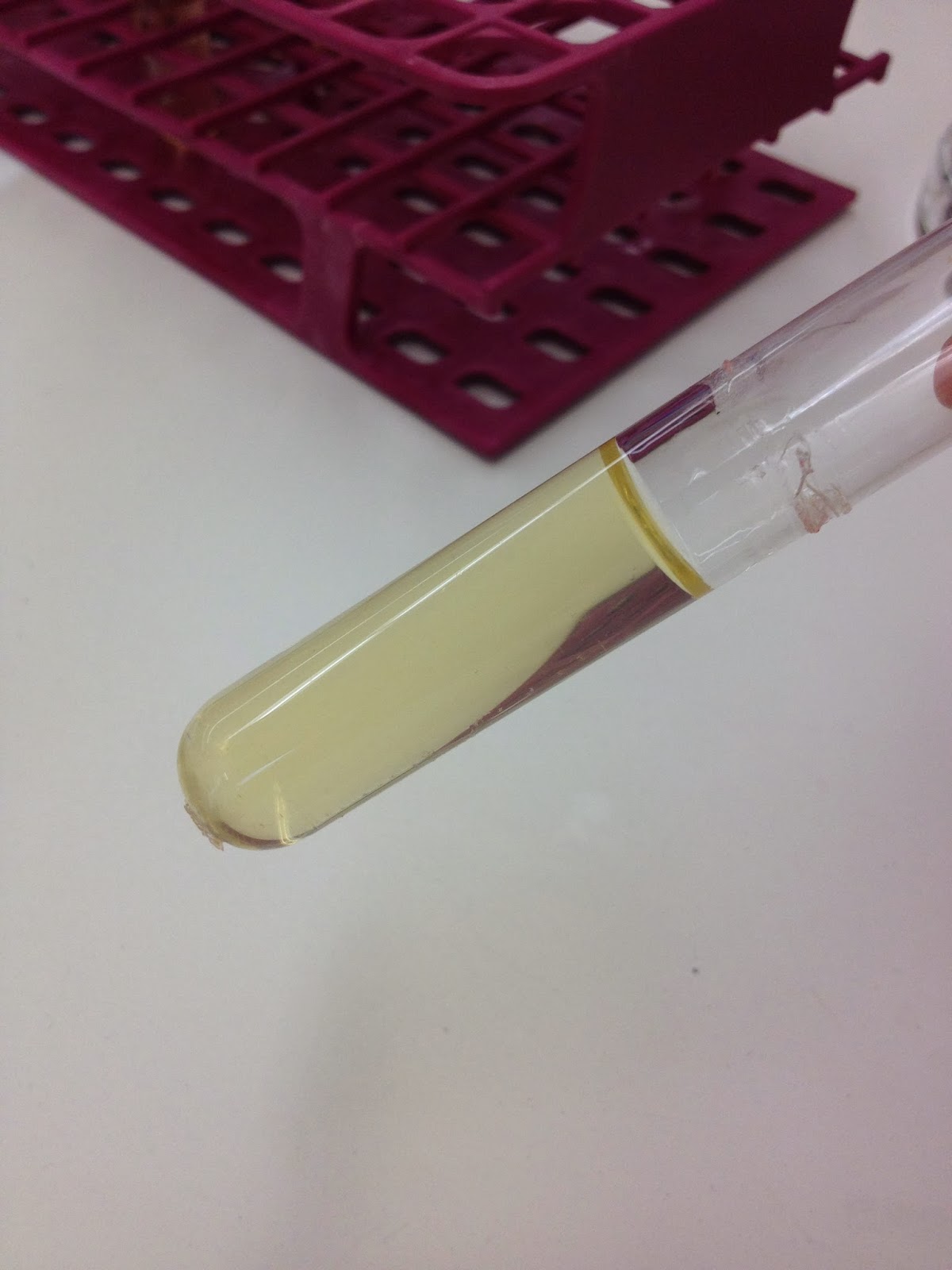 Rose & Lindsey's Medical Microbiology Blog Gelatin Hydrolysis Test